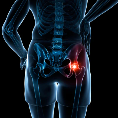 Knee joint MRI at Ayucare Diagnostic Center