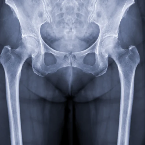 Orbit and PNS MRI at Ayucare Diagnostic Center