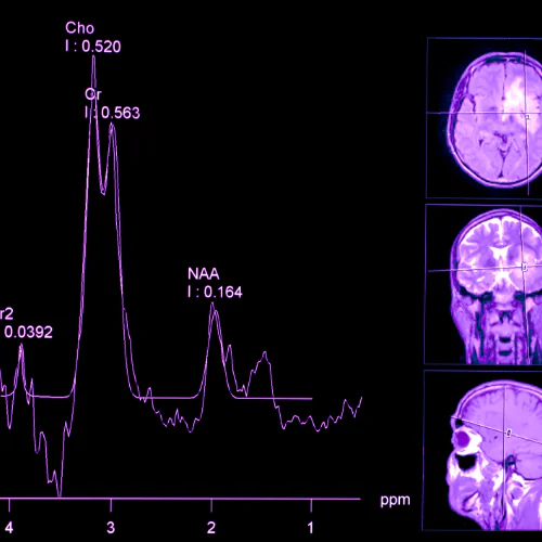Neck MRI at Ayucare Diagnostic Center