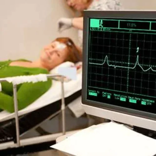 ECG Test